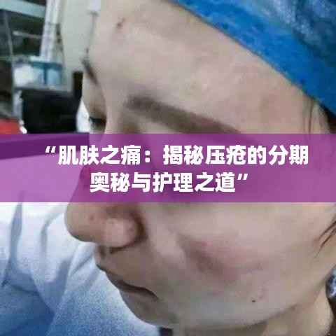 “肌肤之痛：揭秘压疮的分期奥秘与护理之道”