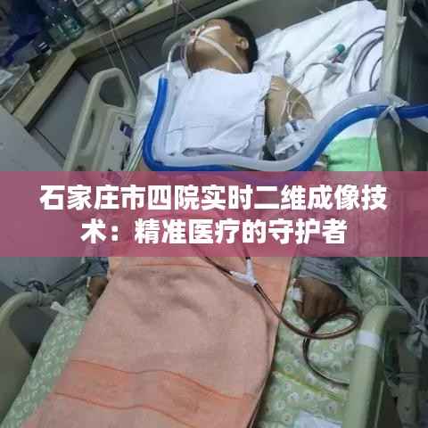 石家庄市四院实时二维成像技术:精准医疗的守护者