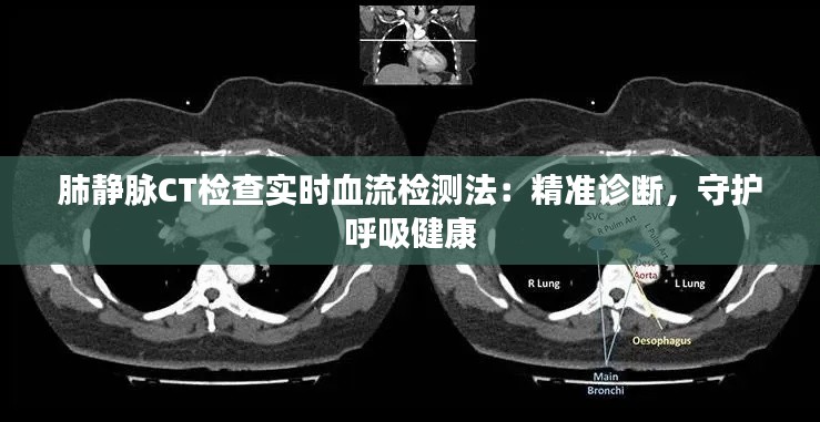 肺静脉CT检查实时血流检测法:精准诊断,守护呼吸健康