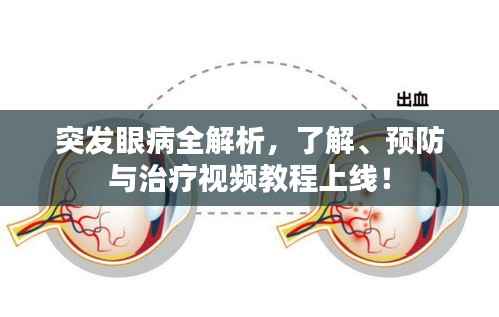 突发眼病全解析,了解、预防与治疗视频教程上线!