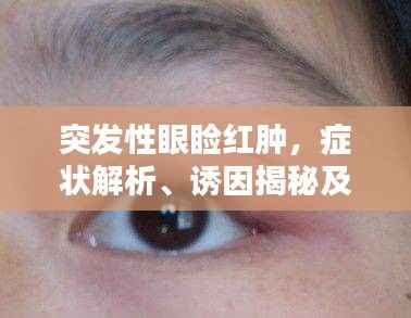 突发性眼睑红肿，症状解析、诱因揭秘及应对良方