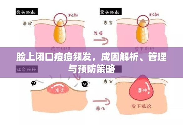 脸上闭口痘痘频发,成因解析、管理与预防策略