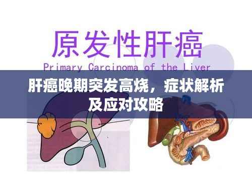 肝癌晚期突发高烧，症状解析及应对攻略