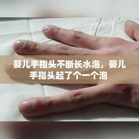 婴儿手指头不断长水泡,婴儿手指头起了个一个泡