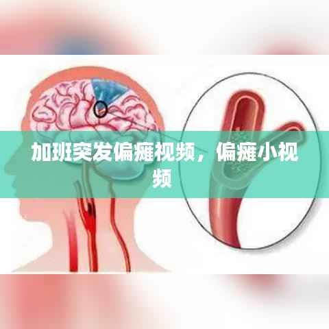 加班突发偏瘫视频,偏瘫小视频