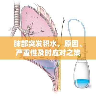 肺部突发积水,原因、严重性及时应对之策
