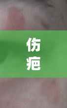 伤疤不断脱落,伤疤不小心脱落怎么办