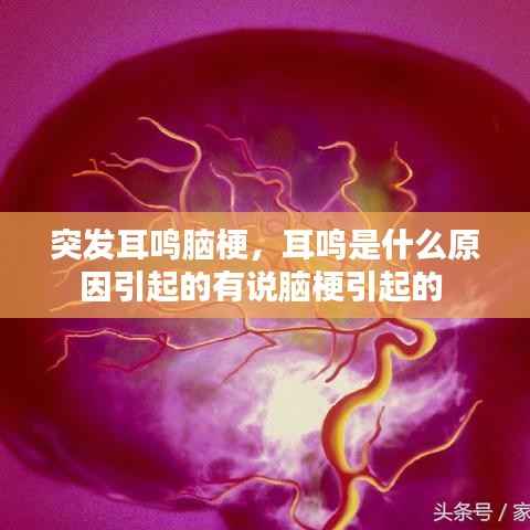 突发耳鸣脑梗,耳鸣是什么原因引起的有说脑梗引起的