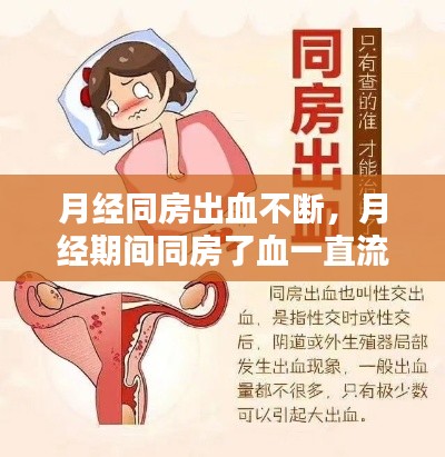 月经同房出血不断，月经期间同房了血一直流怎么办? 