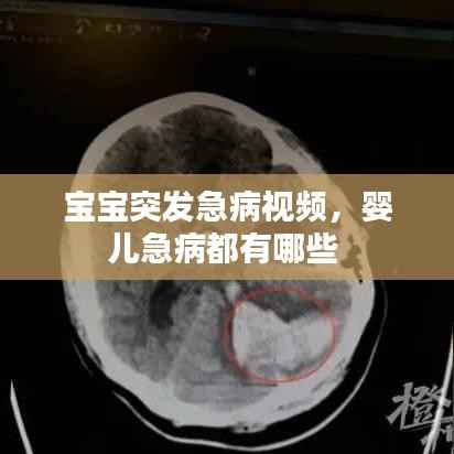 宝宝突发急病视频,婴儿急病都有哪些