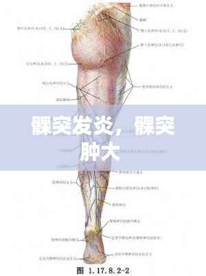 髁突发炎,髁突肿大