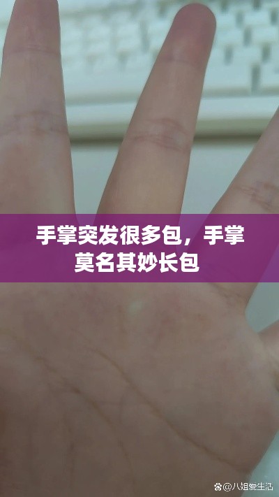 手掌突发很多包，手掌莫名其妙长包 