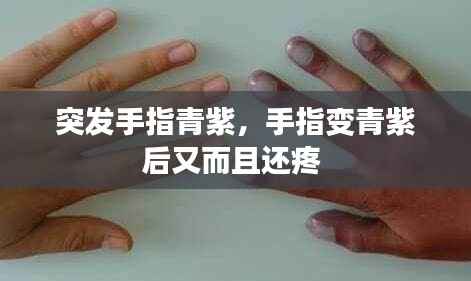 突发手指青紫，手指变青紫后又而且还疼 