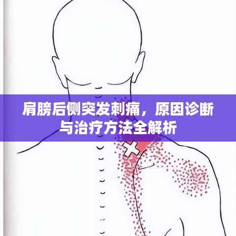 肩膀后侧突发刺痛,原因诊断与治疗方法全解析