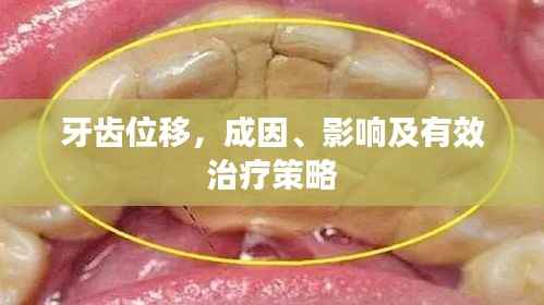 牙齿位移，成因、影响及有效治疗策略