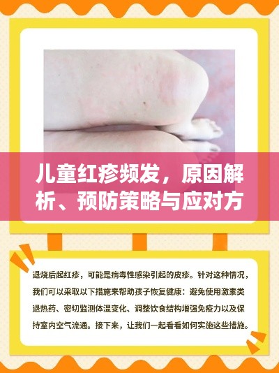 儿童红疹频发，原因解析、预防策略与应对方法