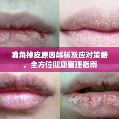 嘴角掉皮原因解析及应对策略,全方位健康管理指南