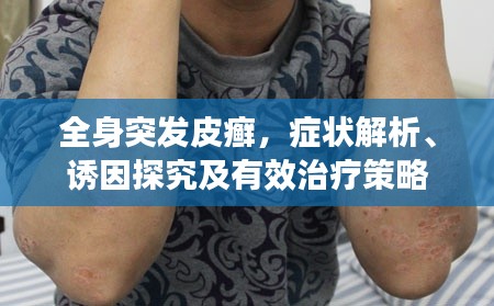 全身突发皮癣,症状解析、诱因探究及有效治疗策略
