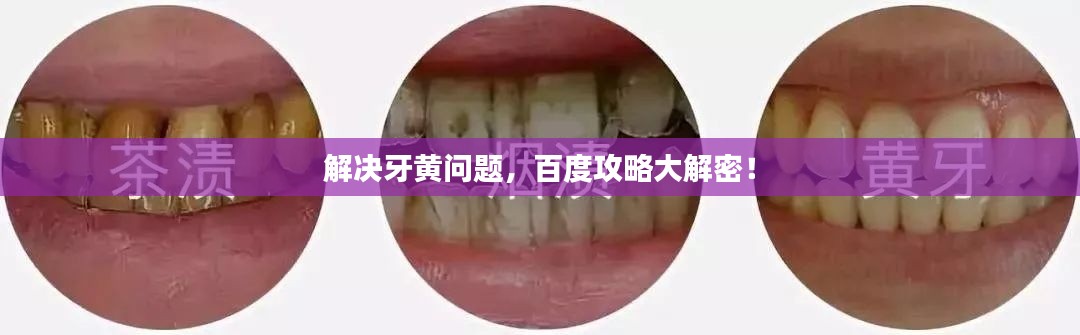 解决牙黄问题,百度攻略大解密!