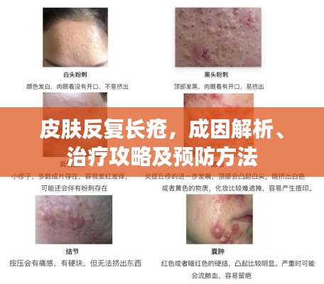 皮肤反复长疮,成因解析、治疗攻略及预防方法