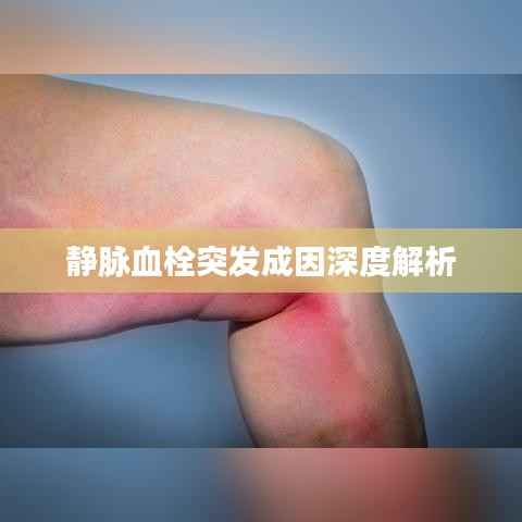 静脉血栓突发成因深度解析