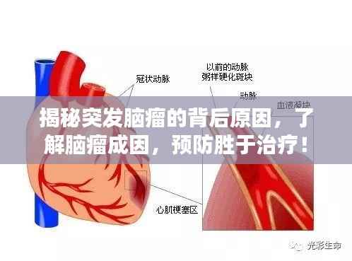 揭秘突发脑瘤的背后原因,了解脑瘤成因,预防胜于治疗!