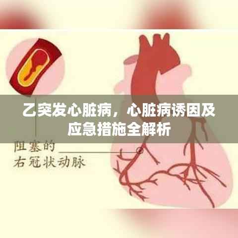 乙突发心脏病,心脏病诱因及应急措施全解析